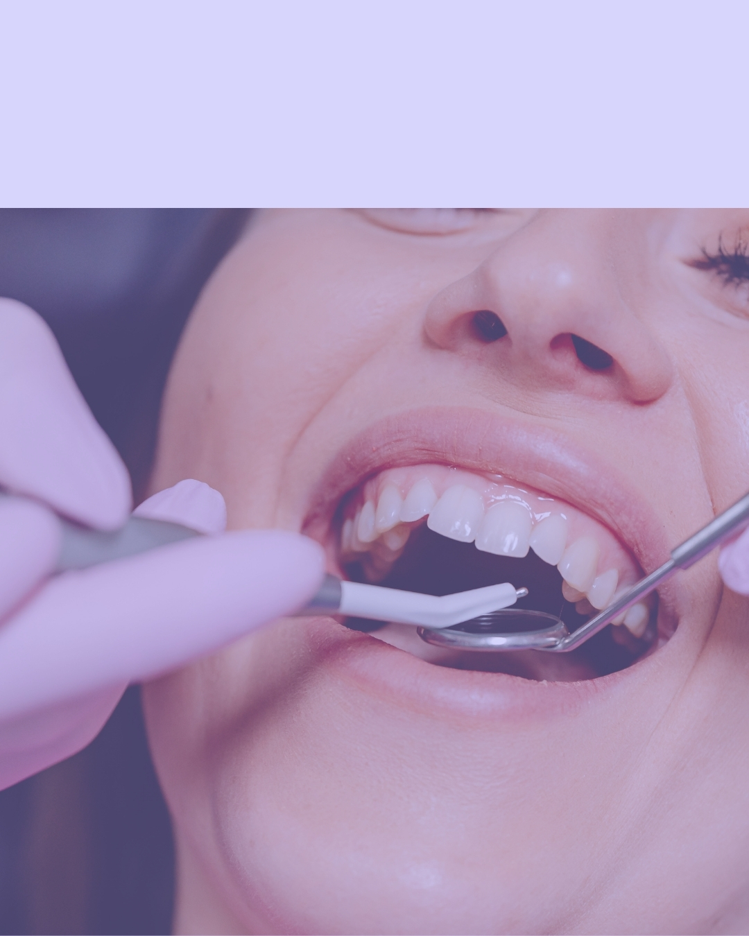 Prótese Dentária - Técnico